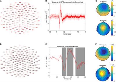 FieldTrip Made Easy: An Analysis Protocol for Group Analysis of the Auditory Steady State Brain Response in Time, Frequency, and Space